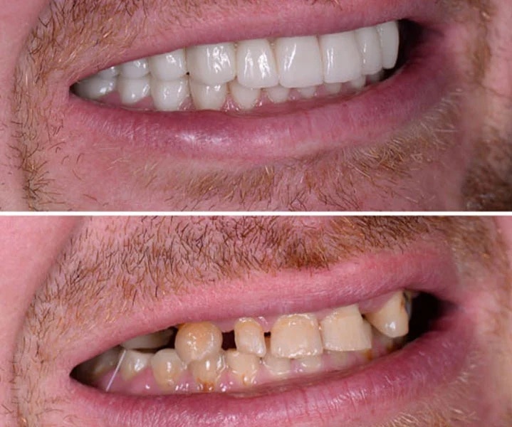 Smile Gallery