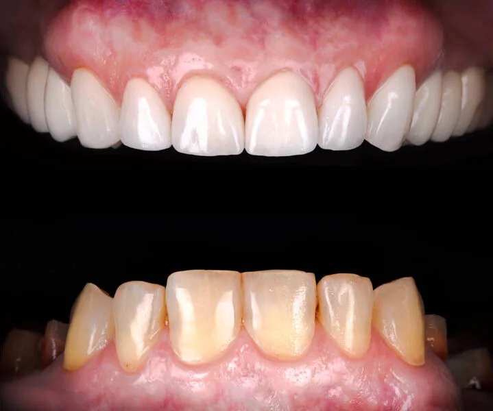 Smile Gallery