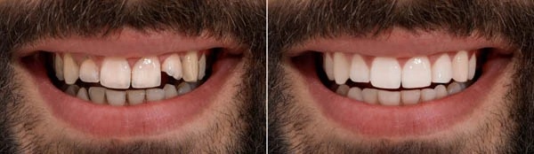 Smile Gallery