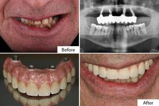 Smile Gallery