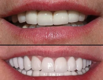 Smile Gallery